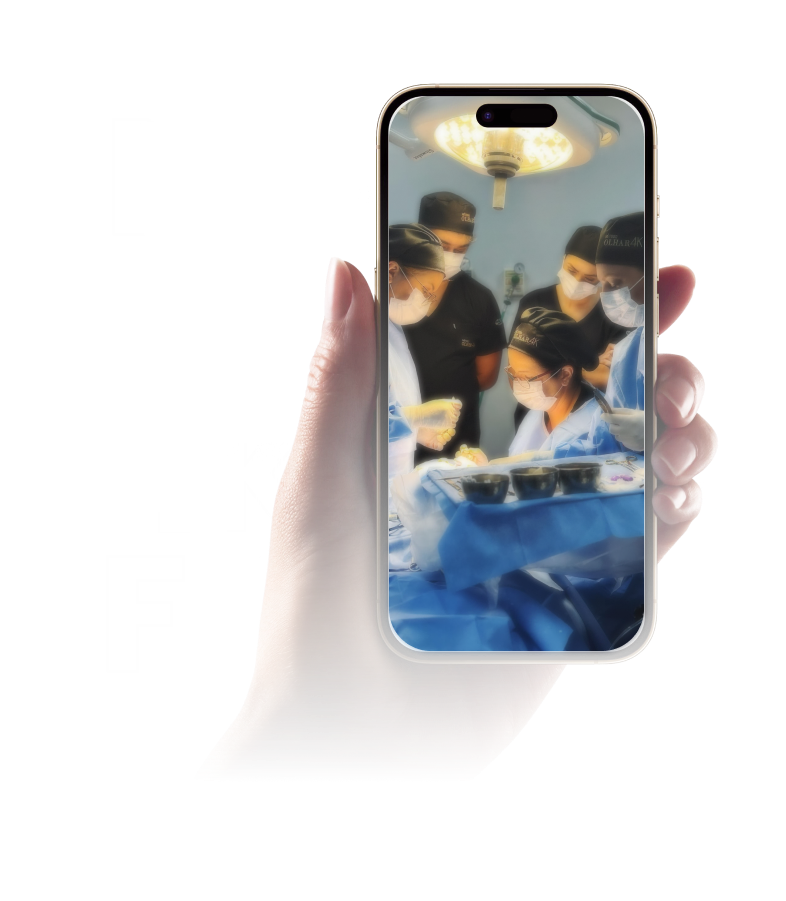 Método Olhar 4K recomendado para iniciantes em procedimentos estéticos para região periocular