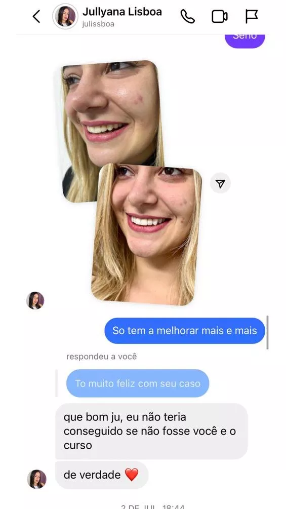 Curso Viver de Lentes em Resina  depoimentos vale a pena