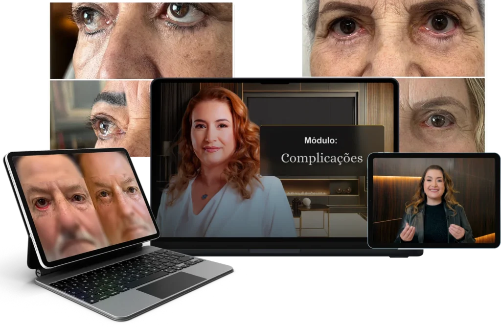 Método Olhar 4K vale a pena e é melhor o curso de Blefaroplastia, Refinamento Orbitopalpebral 2025 para iniciantes